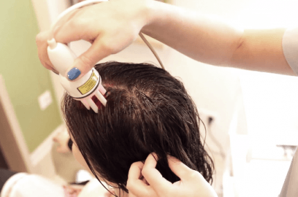 mezoterapia bezigłowa na mokrych włosach